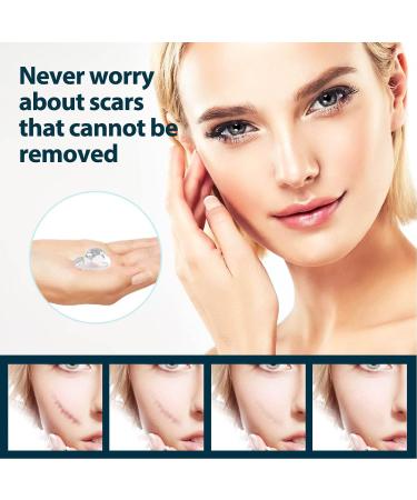 Stretch Mark Gel 2Pcs 50ml with Allantoin & Vitamin E - Hydrating Scar Remover for Scars, Burns & Surgery - Buy Online on GoSupps.com