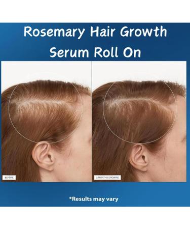 Rosmarin-Haarwachstumsserum roll on s rum naturel l'huile de romarin favorise la croissance et renforce les cheveux Anti-Haarausfall-Roller pour hommes et femmes (6pcs) - Buy Online on GoSupps.com