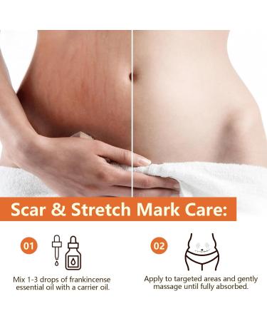 Premium Frankincense Essential Oil for Skin Face Body Wrinkles Scars Therapeutic Grade 100% Natural Pure Frankincense Oil for Face Diffuser Aromatherapy Bath Deeply Nourishing Body Massage Oil 60ml - Buy Online on GoSupps.com