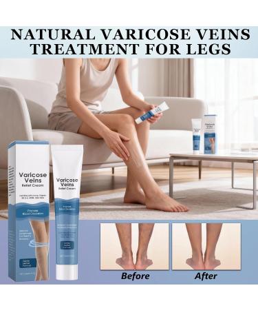 2 Pcs Varicose Veins Cream Varicose Veins Treatment Cream for Leg Skin Repair Improve Blood Circulation Gently Soothe & Moisturize Relieves Legs Discomfort & Reduce Heaviness 20g Each - Buy Online on GoSupps.com