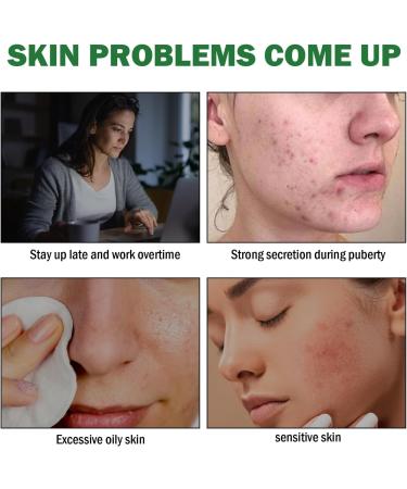 Acne Repair Gel Fade Acne Closure Acne Improve Acne Skin Moisturizing Facial Treatment - Buy Online on GoSupps.com