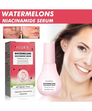 3-Part Watermelon Glow Niacinamide Set | Dew Drops Moisturizer Serum & Brightening Toner | Hydrating Skincare Essentials - Buy Online on GoSupps.com
