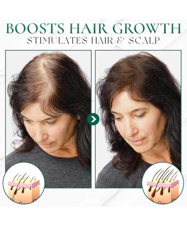  Pemarlis Sea Salt Shampoo Anti-Dandruff Shampoo Natural Shampoo for Oily Hair Deep Cleansing Moisturizing Care and Oil Control - Buy Online on GoSupps.com