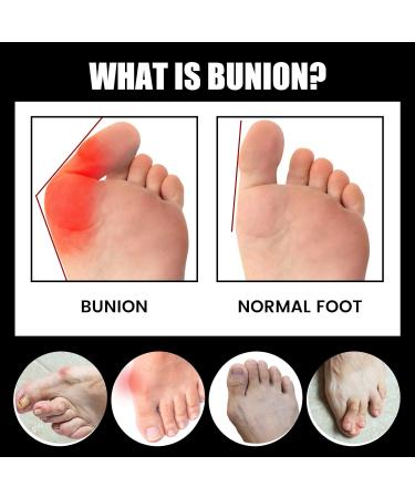 ERGOic Bunion Relief Socks - Anti-Bunion Health Socks for Women and Men - Bunion Corrector Toe Align Socks (Black 5 Pairs) - Buy Online on GoSupps.com