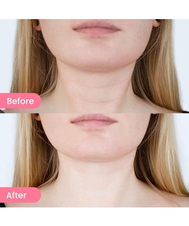 Dr. Pure Face Massager - Double Chin Remover & Neck Sculpting Tool | Portable Facial Beauty Tool for Skin Tightening, Firming, and Smoothing - White - Buy Online on GoSupps.com