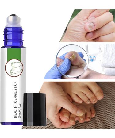  Mimoqk Nail Growth Toenail Repair Natural Nourishing Strengthening Stick Brittle Damaged Nails Toenail Medication Branch For Healthier Stronger Toenails 10ml - Buy Online on GoSupps.com