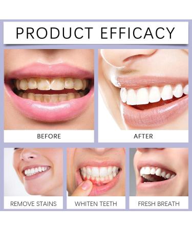 Microcrystalline Hydroxyapatite Powder for Teeth Microcrystalline Hydroxyapatite Tooth Powder Whitening Tooth Powders Stain Removal Powders for Teeth Cleaning (1pcs) - Buy Online on GoSupps.com