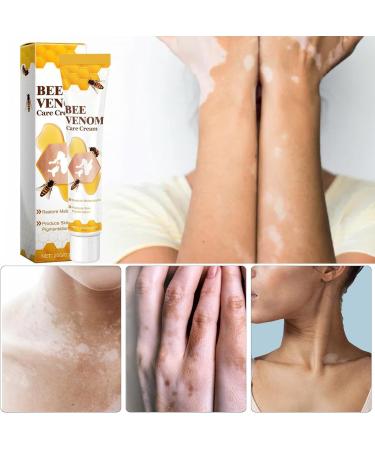 Itch Relief Cream Itch Relief Lotion Redness Relief Cream Rash Cream For Itching External Ointment For Itching Skin Rash Relief Cream Anti-itch Ointment Itchy Skin Cream 20g Rash Cream - Buy Online on GoSupps.com