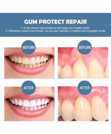 2PCS Dentizen Gum Regrowth Drops Gouttes de Repousse des Gencives Gouttes de Traitement pour La R paration Des Gencives Restauration Des Gencives pour Soins Bucco-Dentaires (3) - Buy Online on GoSupps.com