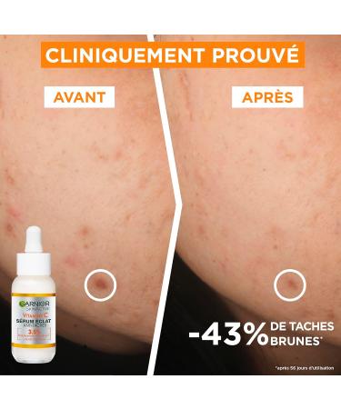  Garnier GARNIER Skin Active - Daily Radiance Routine - Anti-Dark Spot Radiance Serum + Organic Moisturizing Cream - Formulas Enriched with Vitamin C Salicylic Acid & Niacinamide - Dry & Dull Skin - Buy Online on GoSupps.com