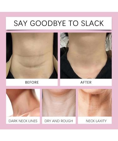 Shantou Youjia Retinol Hall Cream with hyaluronic acid firming and lifting cream for neck and d collet smoothes wrinkles and wrinkles improves sagging skin and vertical lines 50 g - Buy Online on GoSupps.com