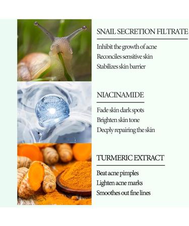 Gift Set Skin Care for Teenage Girls Skincare Set Face Serum Skin Care Sets & Kits:Turmeric Serum Nicotinamide Serum Snail Serum Pamper Gifts for Women Birthdays Christmas Anniversaries - Buy Online on GoSupps.com