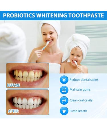 Sp 8 Probiotic Toothpaste Sp 8 Toothpaste Sp-8 Ultra Whitening Probiotic Toothpaste Sp 8 Toothpaste Sp 8 Ultra Toothpaste Designed to protect gums and teeth 120 g - Buy Online on GoSupps.com