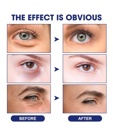 Seagrill Anti-Wrinkle Essence & Glozie Instant Eye Lift Serum - 2PCS Set for Ageless Skin | International Shipping - Buy Online on GoSupps.com