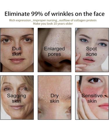 10% Niacinamide Serum+ 1% Zinc Serum Face Moisturizer High-Strength Vitamin Niacinamide Serum Face Serum for Women Minimises Pore Niacinamide Brightening Toner Hydrating Serum for Tackles Blemishes - Buy Online on GoSupps.com