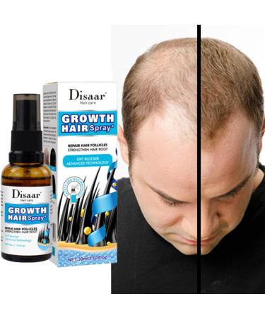 30ml Hair Growth for Women | Hair Thickening Spray for Thin Hair - Keeps Hair Regrowth for Men and Women Hair for Men Women Thinning Repair Care - Buy Online on GoSupps.com