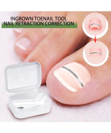 Jubilofex Toenail Correction Plaster 10 Pieces Correction Plaster for Ingrown Nails Repairing Plasters for Nighttime Use for Adults 14 mm - Buy Online on GoSupps.com
