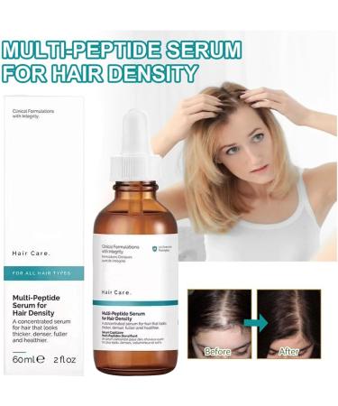 Multi-Peptide Hair Density Serum The Original Ordinary Hair Growth Serum for Men and Women Multi-Peptide Serum for Volume Of Hair Vegan Hair Growth Serum Designed for Thinning Hair & Hair Loss - Buy Online on GoSupps.com