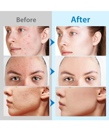  G n rique Glycolic Acid Mask Exfoliating Regenerating Mask for Cleaner and Smoother Skin - Vitamins B3 B5 C E - Effective in Reducing Dark Spots Fine Lines and Wrinkles (40 Tablets) - Buy Online on GoSupps.com