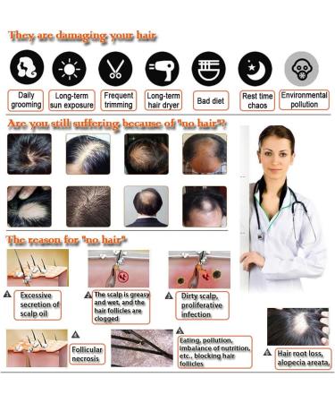  Kingknow Hair Growth Essential Oil Natural Ginger for Hair Loss Treatment Hair Growth Care Ginger Essential Oil Nourishing for Dry Damaged Hair Growth Care 30ml - Buy Online on GoSupps.com