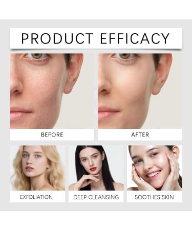 TS TAC-SKY Facial Essence With Niacinamide - Exfoliates Dead Skin Removes Blackheads Hydrates & Refines Pores Gentle Care For All Types(1PCS) - Buy Online on GoSupps.com