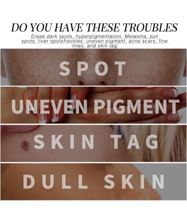 Freckle Repair Essence Anti-Wrinkle Rejuvenation Whitening Skin Fades Facial Wrinkles Fine Lines Spots 30ml - Buy Online on GoSupps.com