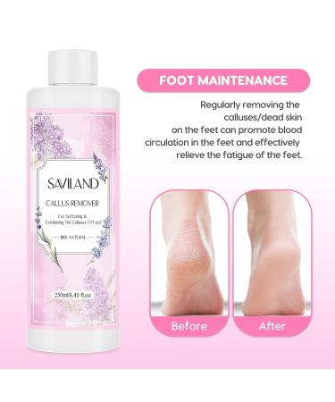 Saviland Callus Remover Kit - 8.45 fl Oz Gel for Dead Skin Removal with Foot File, Scrubber, Pumice Stone, and Gloves - Pedicure Set for Foot Care and Spa Treatment at Home - Buy Online on GoSupps.com
