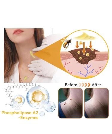 FROPUN Bee Venom Removal Cream - 100% Natural Fast-Acting Repair Cream for Adults - Maximum Strength Skin Care for Men & Women (1 Floz - Buy Online on GoSupps.com