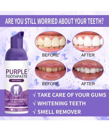 Lila Toothpaste for White Teeth - Purple Tooth Whitening Paste 60g (2-Pack) | Fresh Breath & Stain Removal - Buy Online on GoSupps.com