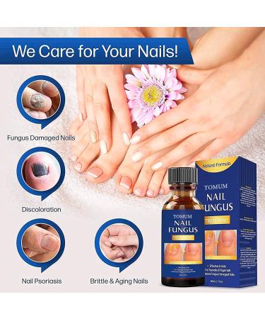 Extra Strength Toe Nail Fungus Treatment for Healthy Nails - Nail Repair Solution - Buy Online on GoSupps.com