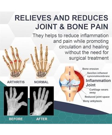 Plebolo Bee Venom Pain and Bone Healing Cream Bee Venom Joint and Bone Relief Cream New Zealand Joint and Bone Therapy Cream Bee Venom Pain Relief Cream for Back Neck Hands Feet (2pcs-B) - Buy Online on GoSupps.com