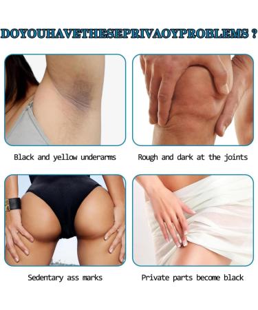 Arm Pit Brightening Cream Skin Lightening Cream Under Arm Cream For Women Body Cream For Dark Skin Bright Skin Cream Natural Underarm Lightening Cream Inner Thigh Lightening Cream - Buy Online on GoSupps.com