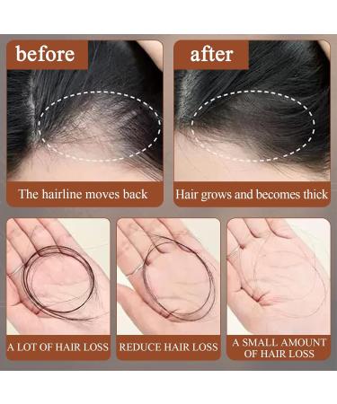 Botana Hair Growth Oil Batana Oil Organic Organic Batana Oil Pure Raw Batana Oil For Hair Growth Repair Damaged Hair Hair Smoothing Conditioner for Damage Protective for Men Women - Buy Online on GoSupps.com