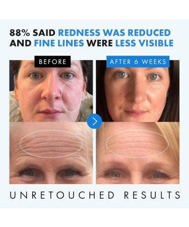 Hydrating & Brightening Hyaluronic Acid Face Serum with Vitamin C & E - Anti Aging Formula for All Skin Types - Buy Online on GoSupps.com