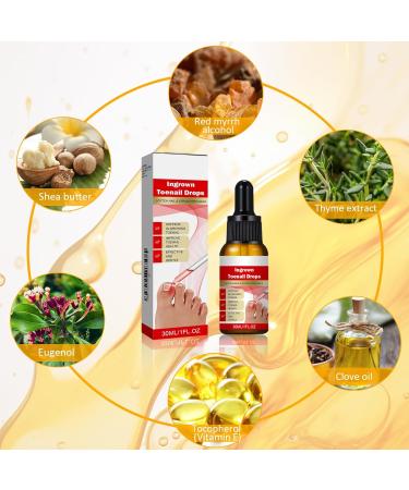 30ml Ingrown Toenail Treatment Drop Natural Ingrown Toenail Correction Oil Cuticle Care Oils for Toe Fungal Nail Treatment Trimming Nail Softening Drop Extra Strong for Damaged Nails - Buy Online on GoSupps.com