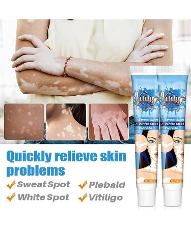 EXQST Vitiligo Therapy Cream - Reduce White Spots, Improve Skin Pigmentation - 5 Pcs - Buy Online on GoSupps.com