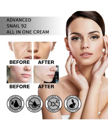 Snail Mucin 92% Repair Cream - Daily Moisturizer for Dry Acne-Prone & Sensitive Skin | 100g Cruelty-Free Paraben-Free - Buy Online on GoSupps.com