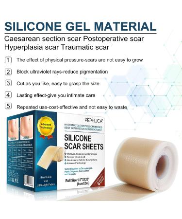 Medical Grade Silicone Scar Sheets - 1.6 x 120 Inch - For Old & New Scars - Safe & Painless Scar Removal - Face, Body, Surgery, C-Section, Keloid, Burn - 7 Months Supply - Buy Online on GoSupps.com