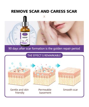 AICHUN BEAUTY Lavender Extract Scar Repair Essence | Anti-Scar Essential Oil for Smooth Skin | 30ml - Buy Online on GoSupps.com