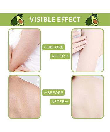 Avocado Body Scrub Exfoliating Body Scrub Body Exfoliator Foot Scrub Dead Skin Remover for Body Natural Deep Cleansing Softening & Nourishing Skin Exfoliator for Men Women - Buy Online on GoSupps.com