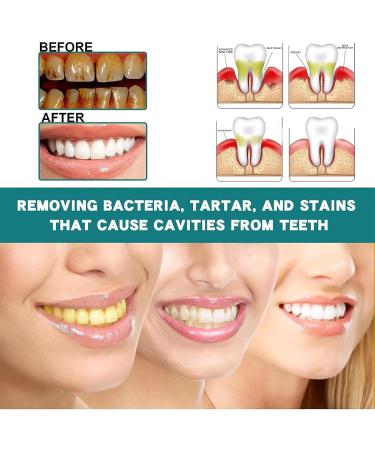 Ampoule Toothpaste Essence Ampoule Toothpaste Teeth Whitening Ampoule Toothpaste Tartar Plaque Toothpaste Tartar and Plaque Removal - Buy Online on GoSupps.com