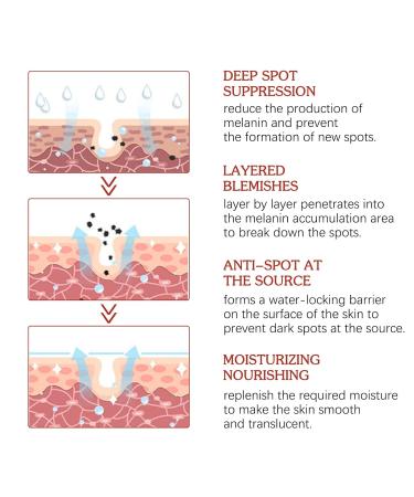 2Pcs Crema Para Manchas Oscuras En La Cara Cremas Para Las Manchas de La Cara Vitamin C&E Face Moisturizer Cream Crema Aclaradora Para Piel Manchas En Cara - Buy Online on GoSupps.com