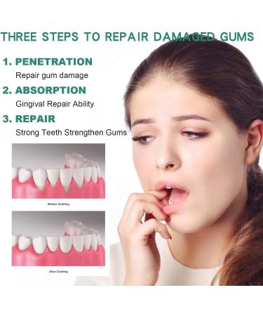 Dentizen Gouttes de repousse des gencives traitement de repousse des gencives restauration naturelle des gencives avec gouttes liquides bain de bouche repousse des gencives (1 pi ce) 1 Pi ce. - Buy Online on GoSupps.com