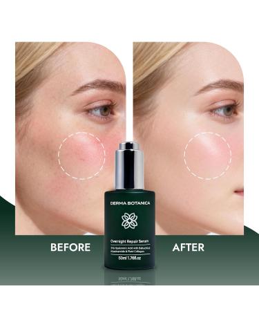 Derma Botanica Overnight Serum Derma Botanica Overnight Repair Serum Luxurious Night Facial Serum with Peptide Complex 1.7 Fl Oz(1PCS) - Buy Online on GoSupps.com