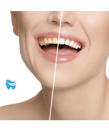 Dr. Dent Bright Tooth Bleaching Set | Safe & Effective Home Whitening Kit for Sensitive Teeth | LED Light Lightening Gel Mouth Rails Shade Guide | Top Quality Teeth Whitening Solution - Buy Online on GoSupps.com