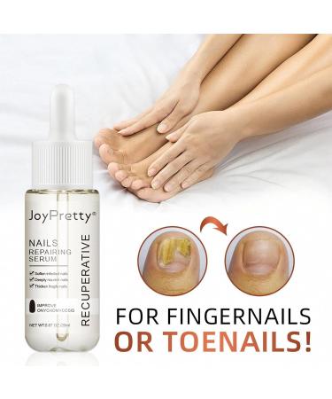 ILOVMUP Nail Cuticle Oil Nail Treatment for Dry & Damaged Nails Cuticle Care Oil for Fungal Nail & Toenails Strength Nail Oil for Moisturizing and Repairing Cracked Nail - 20ml - Buy Online on GoSupps.com