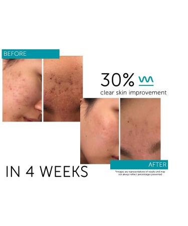 FactorFive Regenerative Serum with Stem Cell Growth Factors for Skin Tightening & Smoothing | Wrinkle & Pore Reduction | Rejuvenation - 1 fl oz - Buy Online on GoSupps.com