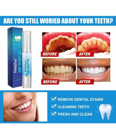 2 Pieces Dentizers Gum Therapy Gel | Safe & Effective Tooth Whitening & Stain Remover - Buy Online on GoSupps.com
