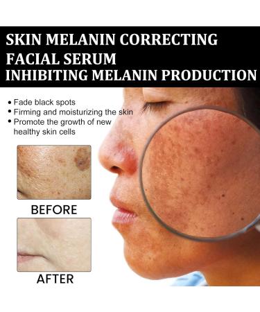  BAInuai Melanin Face Correcting Serum Sotck Solution Face Repair Essence Dark Spot Repair Melanin Anti-Oxidation Serum Moisturizing Serum Whitening and Melanin (3 - Buy Online on GoSupps.com