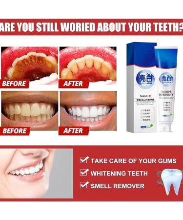 SP-4 Probiotic Whitening Toothpaste | Ultra Whitening & Stain Removal | Fresh Breath | 3 Pack - Buy Online on GoSupps.com